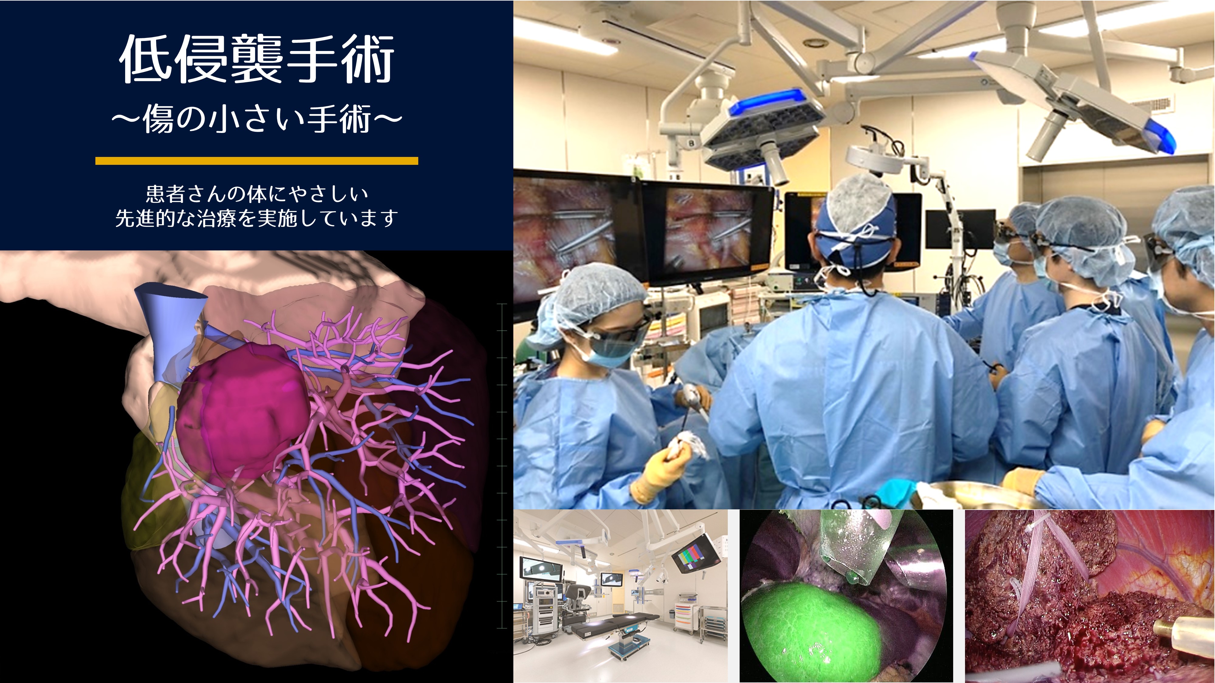 肝胆膵・移植班｜慶應義塾大学病院 一般・消化器外科 トップ３