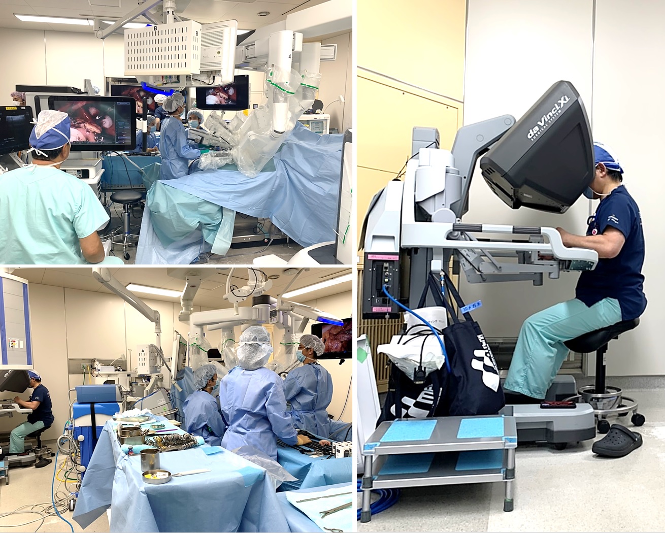 活動報告｜ロボット支援下膵頭十二指腸切除術 初例（2021.6.17）