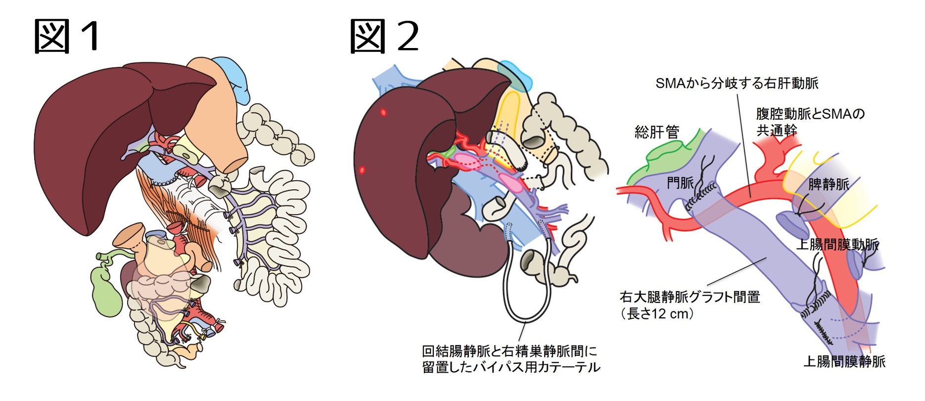 図1.高度進行・再発がん（難治がん）への取り組み