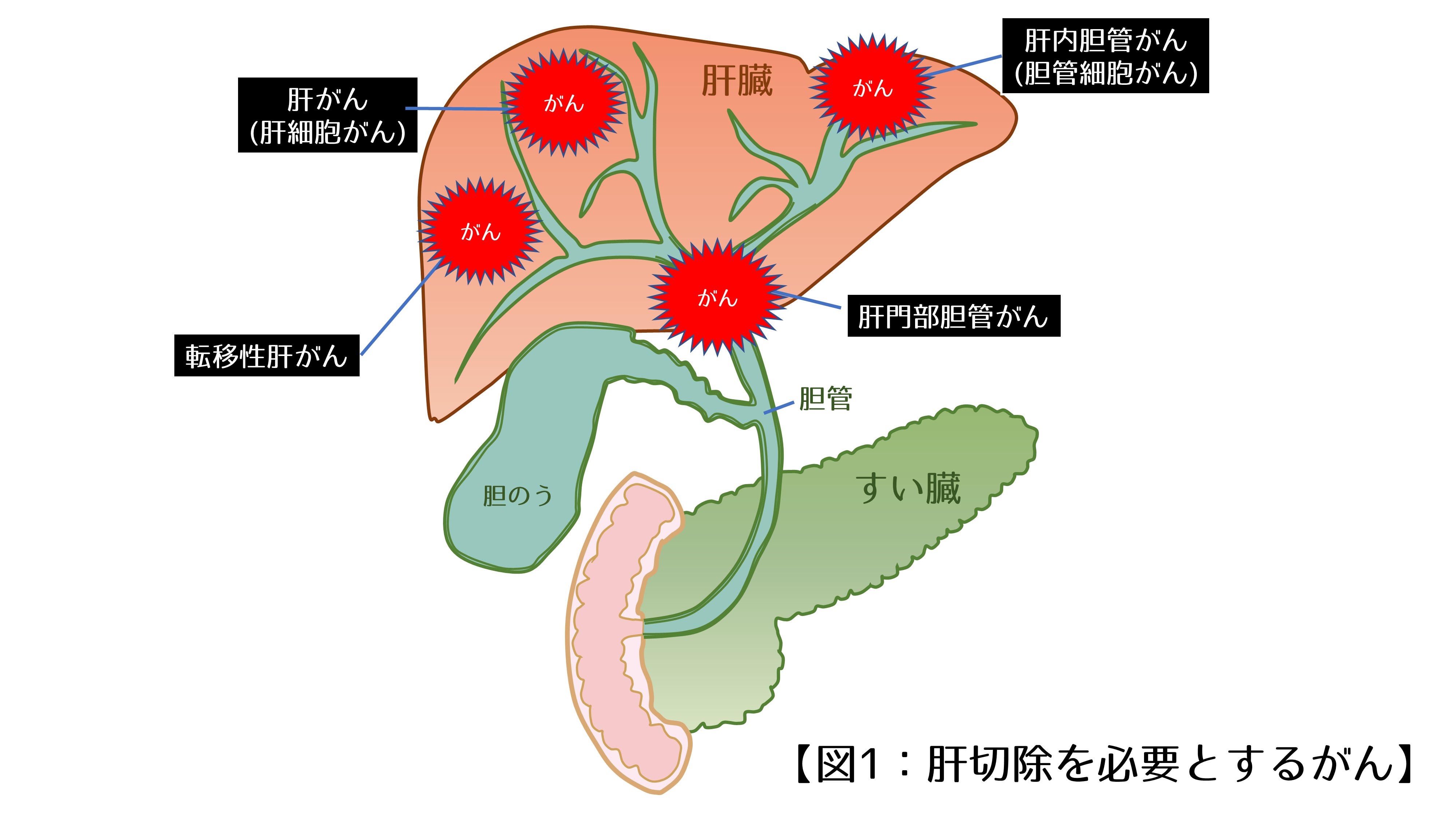 する に 肝臓 を は よく 肝臓に良い食べ物・飲み物｜肝臓に悪い食べ物・食品