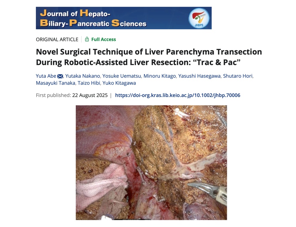 Hepatobiliary Pancreat Sci誌2025年8月22日号｜腹腔鏡下肝切除