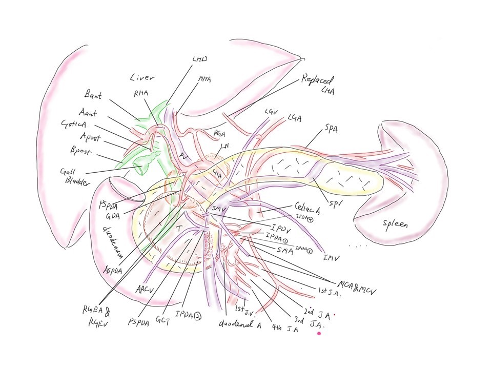 図1.若手肝胆膵外科医のための手術イラスト１