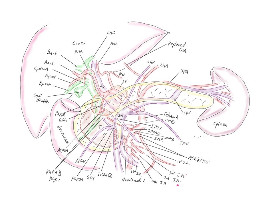 若手肝胆膵外科医のための手術イラスト 肝胆膵 移植班 慶應義塾大学病院 一般 消化器外科